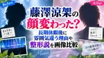藤澤涼架の顔変わった？長期休暇後に雰囲気違う理由や整形説を画像比較