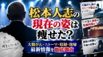 松本人志の現在の姿は痩せた？大腸がん後のストーマ除去はいつ・ハゲ芸人寄席の収録時期も調査