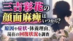 三吉彩花の顔面麻痺はいつから？原因や症状・休養理由、現在の回復状況を調査